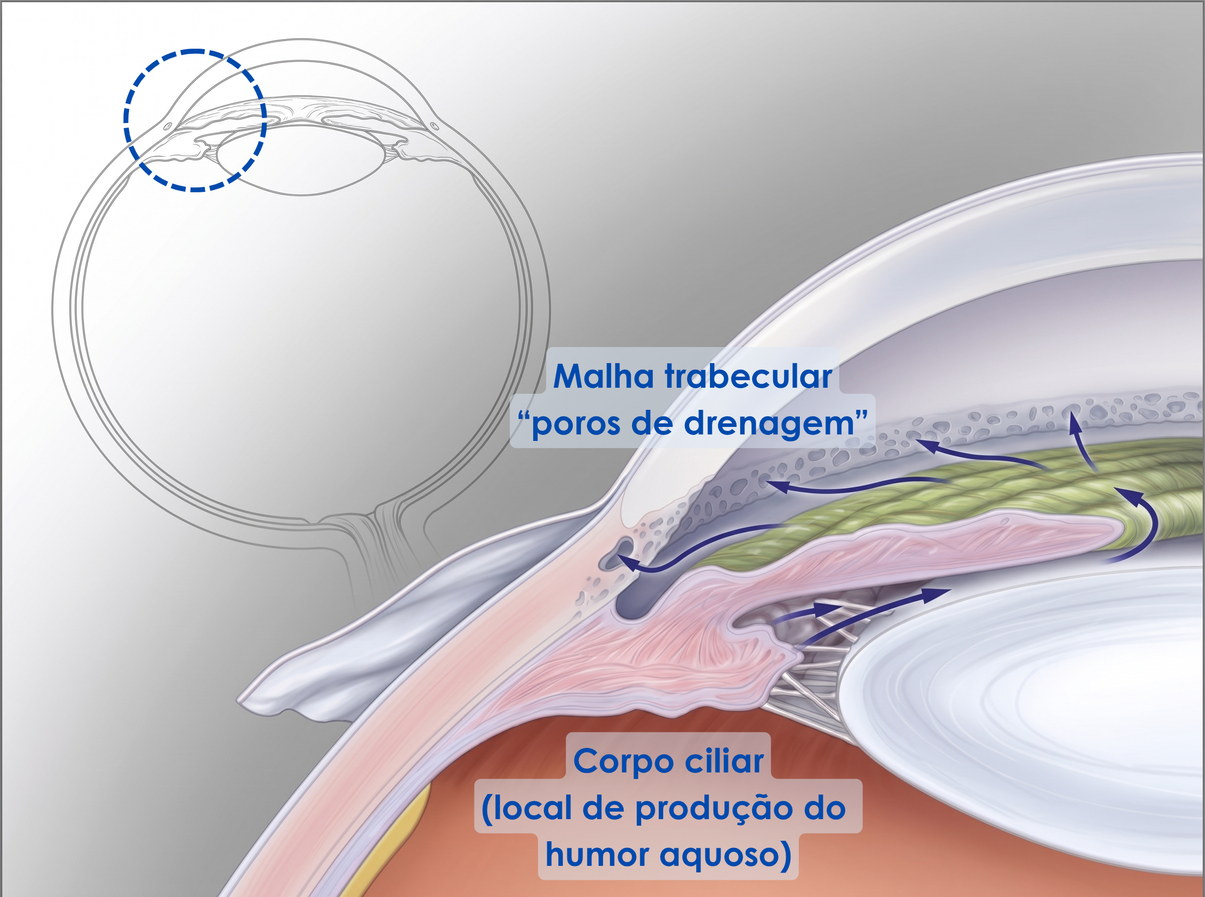 Malha-trabecular-poros-de-drenagem-.png